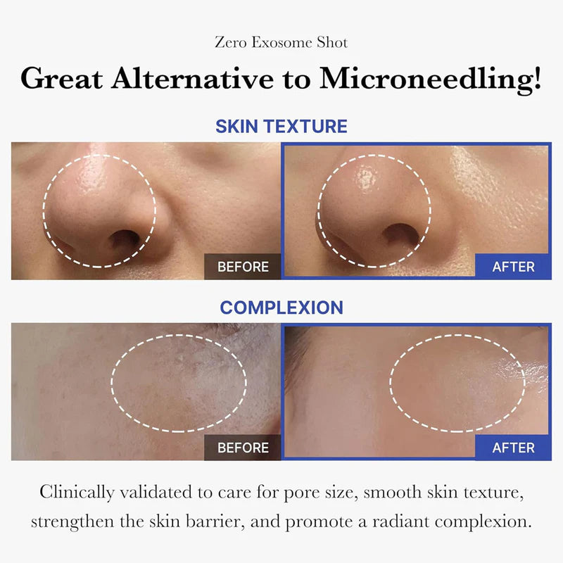 Medicube One Day Exosome Shot – Advanced Skin Repair & Glow Treatment